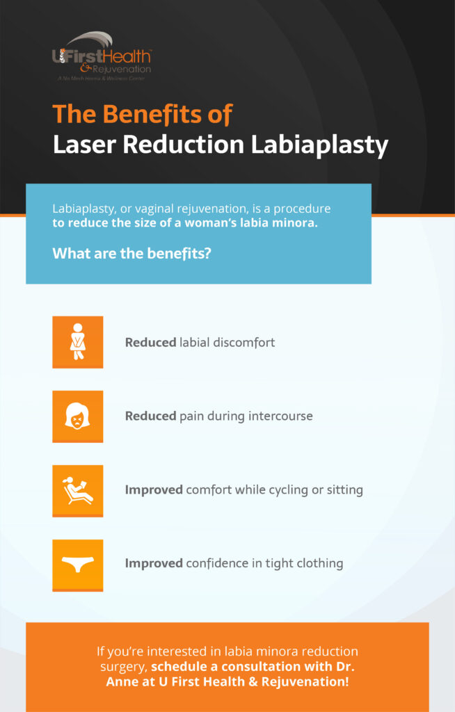 Benefits of laser reduction labiaplasty in Fort Myers, FL